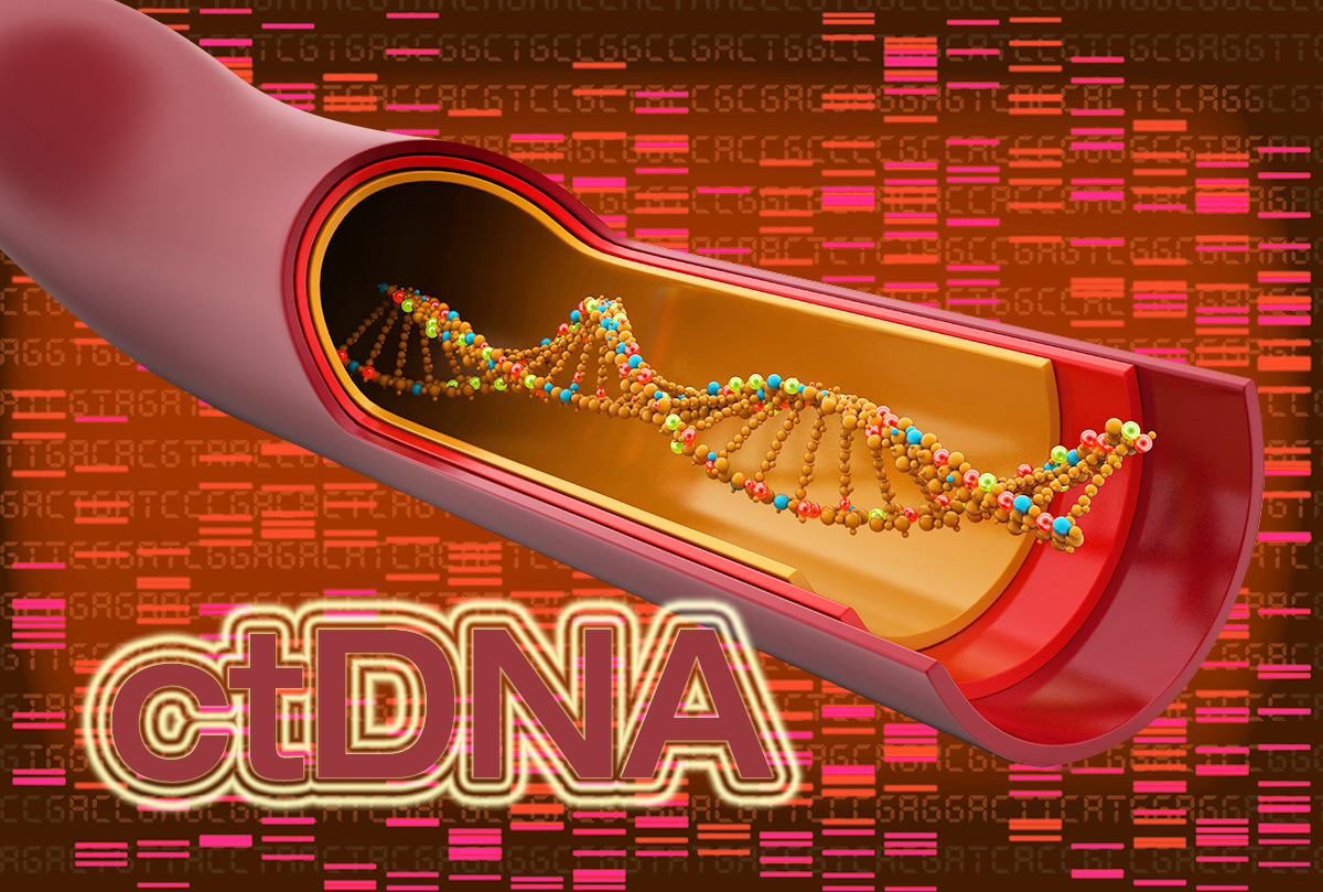 Sinh thiết lỏng ctDNA phát hiện sớm 9 loại ung thư thường gặp