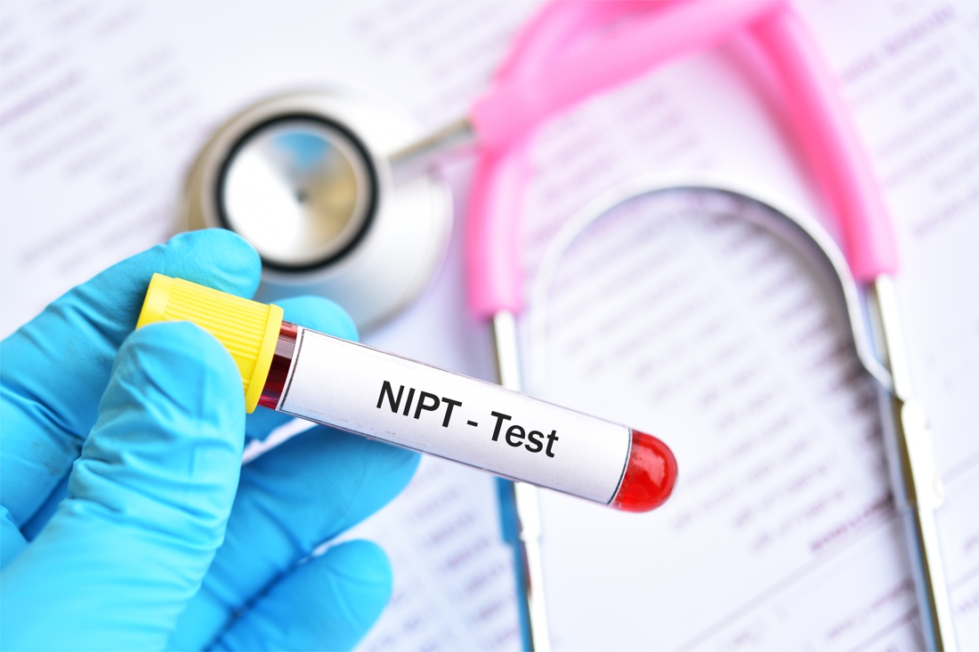 Các yếu tố cần xem xét khi lựa chọn xét nghiệm NIPT
